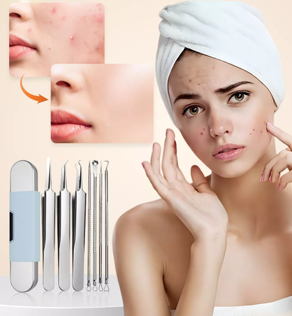 🔥【Oferta especial】Precisión No.5 💆‍♀️Set antibacteriano de acero inoxidable para eliminar espinillas, con extractor de puntos negros y pinza para acné