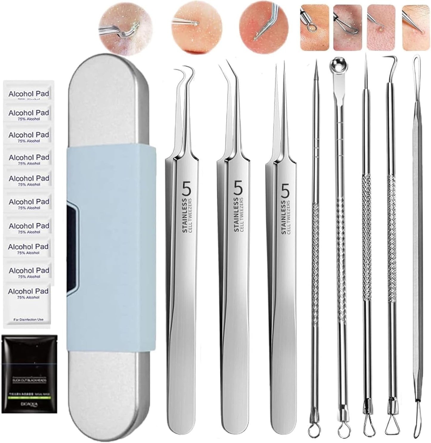🔥【Oferta especial】Precisión No.5 💆‍♀️Set antibacteriano de acero inoxidable para eliminar espinillas, con extractor de puntos negros y pinza para acné