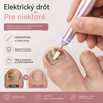 💅👍 Elektryczny pilnik do paznokci do pielęgnacji paznokci z grzybicą