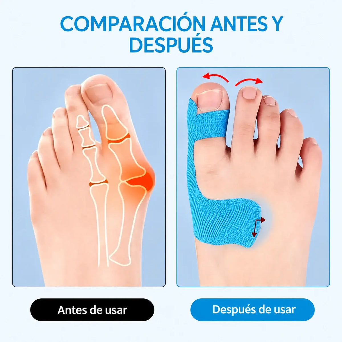 【50 uds】Protector de dedos flexible, vendaje para quemaduras y soporte deportivo, cinta autoadhesiva resistente al desgaste