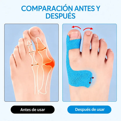 【50 uds】Protector de dedos flexible, vendaje para quemaduras y soporte deportivo, cinta autoadhesiva resistente al desgaste